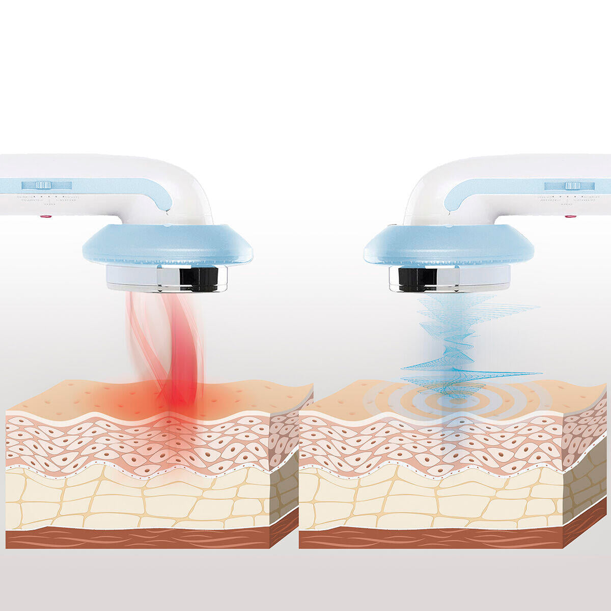 SlimGlow™: Dispositivo 3 en 1 para eliminar la celulitis y redefinir tu cuerpo